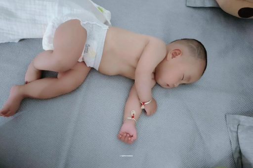 长宁宝宝头上长痱子 长宁宝宝头上长痱子